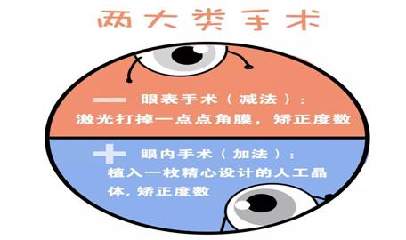 最新近視矯正技術(shù),最新近視矯正技術(shù)，重塑清晰視界