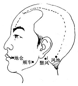 機(jī)械零部件 第13頁