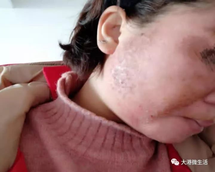 最新寶顏術(shù)，探索美容新境界的奧秘